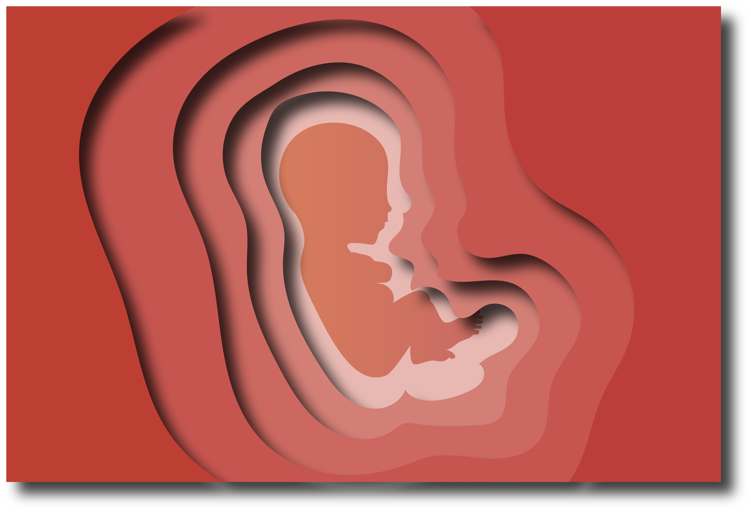 Abortion MFAUGHT